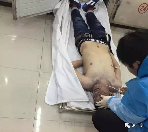 倒在导师饭局后的研究生：5桌喝25瓶白酒