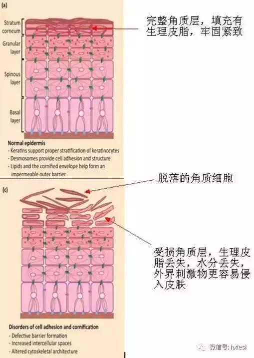 红血丝多如何快速消除,红血丝怎么调理身体