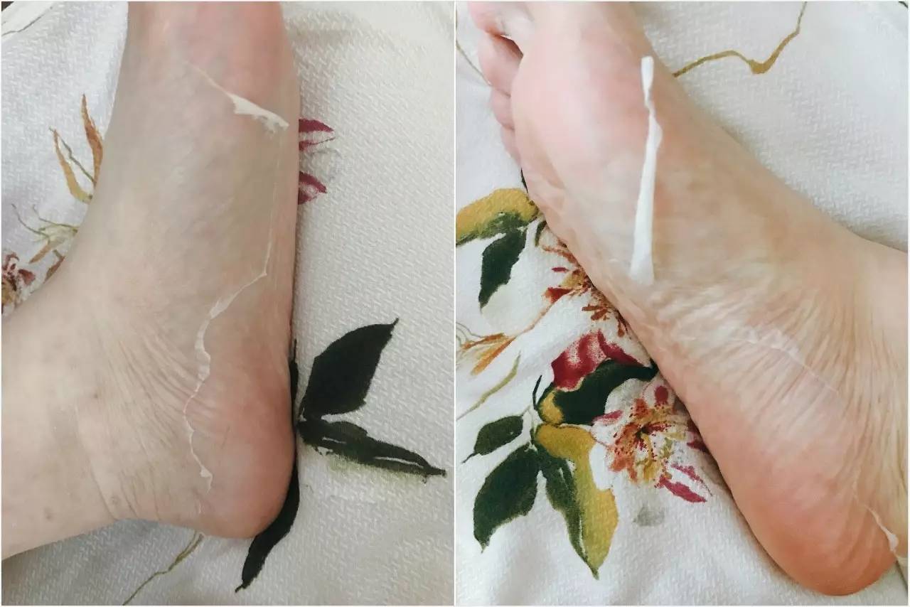 为什么总觉得自己不适合穿高跟鞋,为啥穿高跟鞋不好看