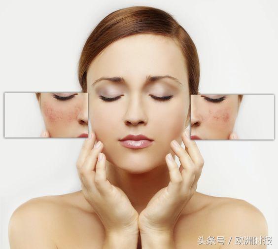 面对“阳光后遗症”，敏感肌肤该如何选择产品？