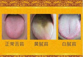 湿气重苦不堪言，怎么祛除体内湿气，叫你一招，轻松祛湿！