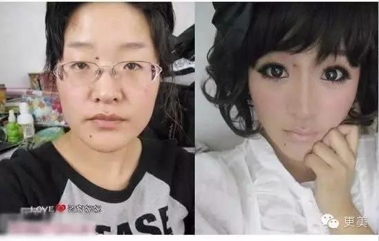 脸部缝美容线好还是普通线好,医院埋线和美容院埋线有什么差别