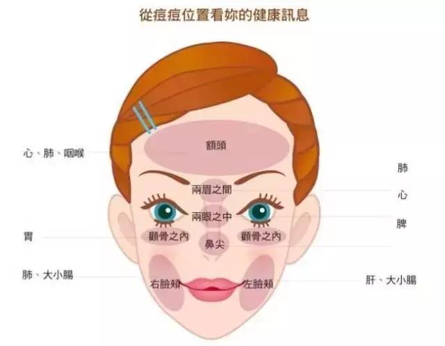 长痘痘的十大原因,什么才是长痘痘的罪魁祸首