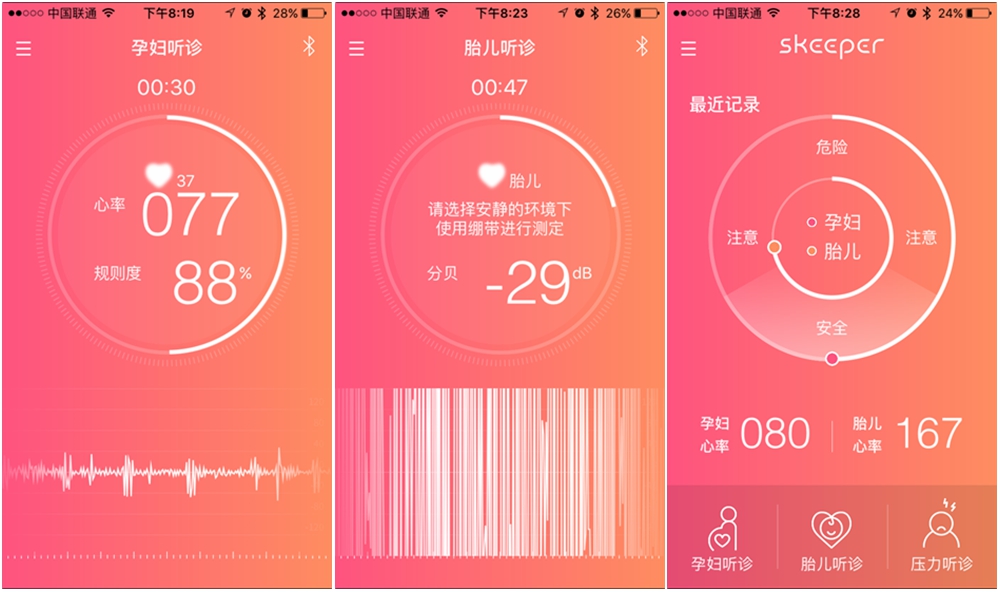 智能心脏检测器,实时心脏监测手环