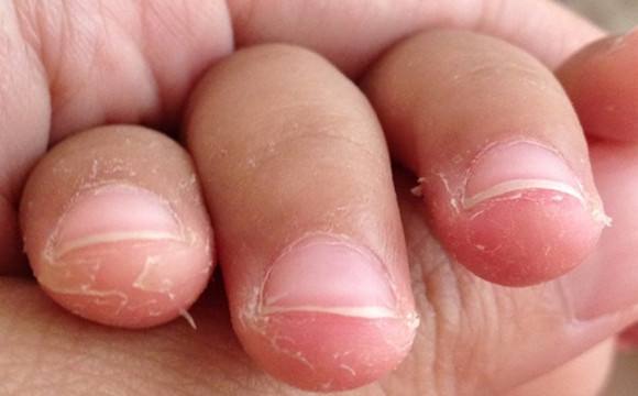 孩子挑食的危害视频,孩子偏食挑食的妙招