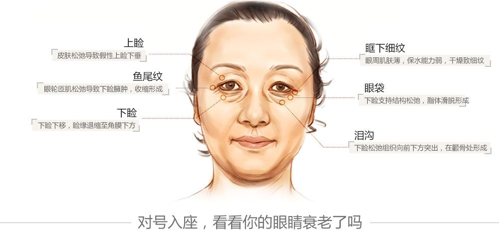 祛皱抗衰要趁早等皱纹出来就晚了,眼周皱纹用滋润还是紧致
