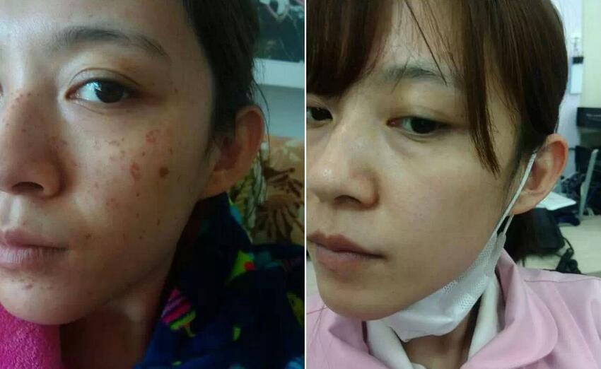 老师讲解祛斑技术的文案,祖传中医教你如何祛斑