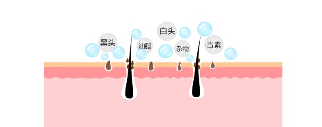 原来去黑头这么简单？干货经验贴