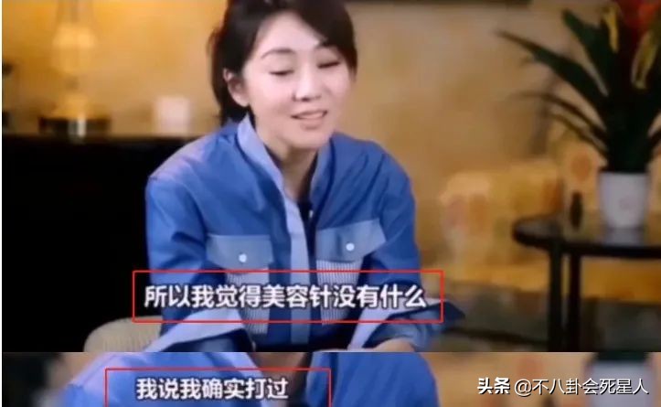 女星变老像蔡明,脸变僵的明星