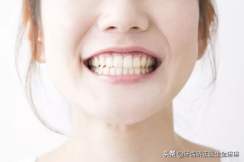 淄博诺尔漫齿科洗牙怎么样,淄博诺尔漫口腔医院