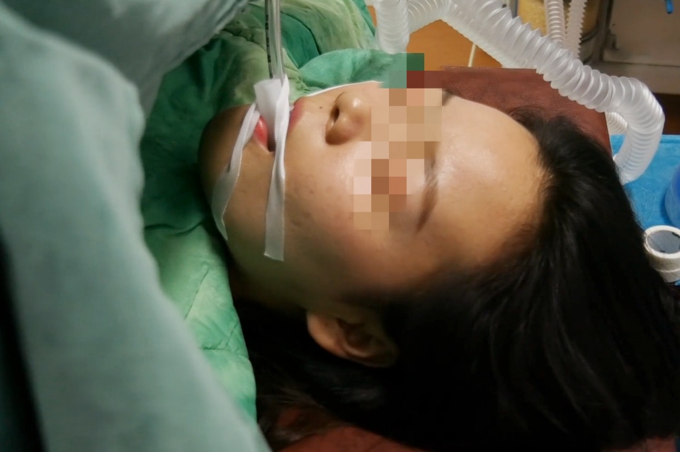 剖腹产术后有多疼？经历过的产妇都知道，有一种痛叫“举步维艰”