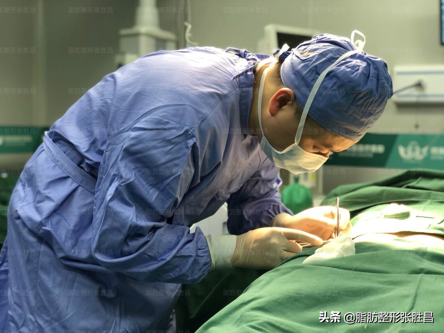 吸脂手术的疤痕怎么消除,吸脂针眼可以激光去除吗