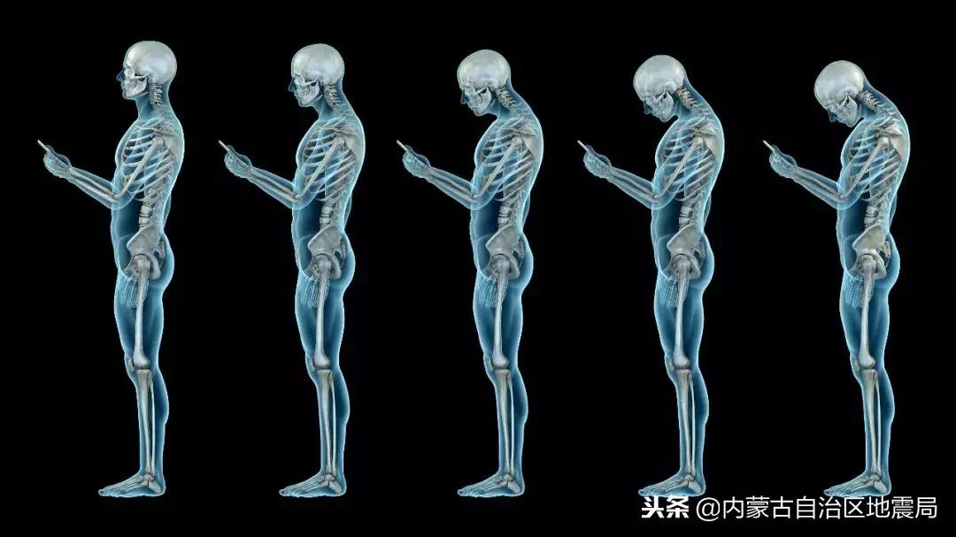 这个小动作竟可能导致瘫痪！吓得我赶紧放下手机……