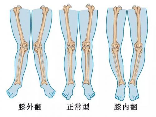 刚出生的小孩腿怎么伸不直,新生儿需要把腿捆上吗
