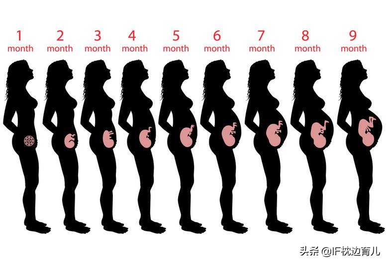 怀孕后怎么防止妊娠纹,怀孕后怎么预防妊娠纹