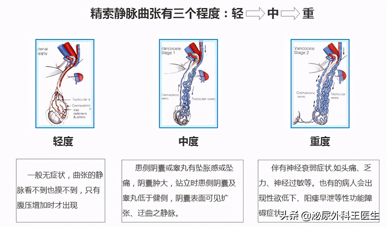 精子品质太差怎么能提高精子品质,人的精子干净程度