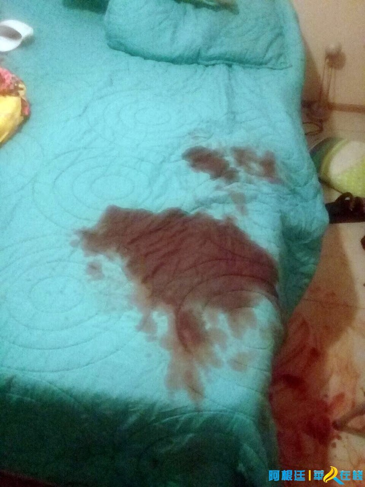 阿根廷年轻女子狱中自述为何痛下杀手剪断情人“命根子”？