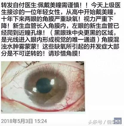 乱戴美瞳对眼睛有什么伤害,第一次戴美瞳眼睛差点瞎