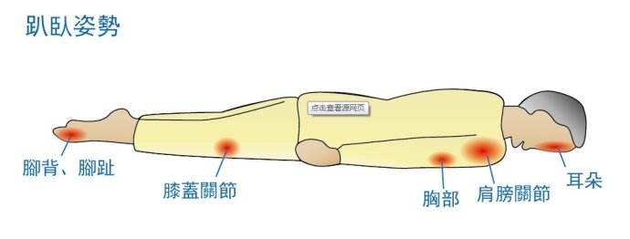 压疮的处理措施,压疮是什么怎么防治