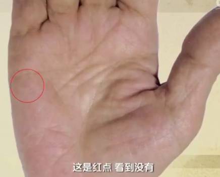 手健康有多重要,手健康的表现