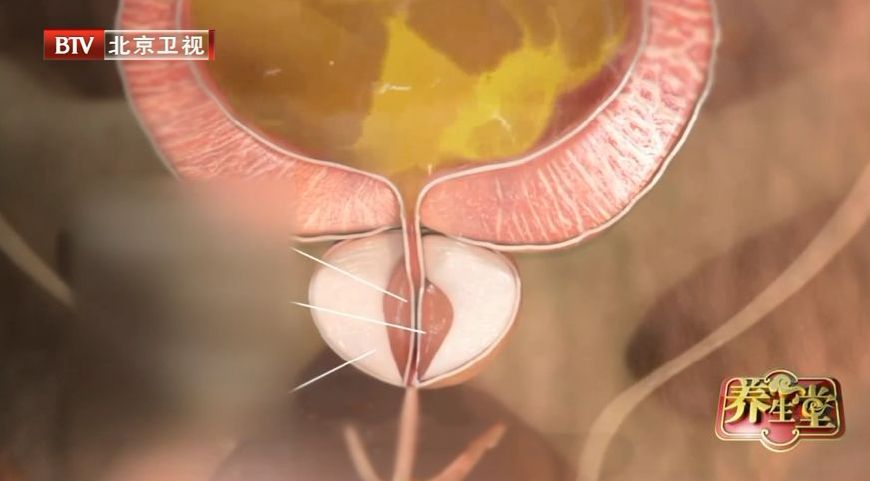 膀胱有问题，这些疾病都会找上门！忽视“漏尿”，当心拖成尿毒症