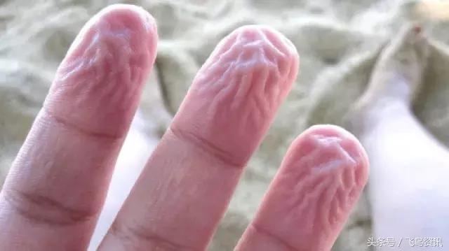 手指为什么泡水特别容易烂,手指泡水后发白像烂了