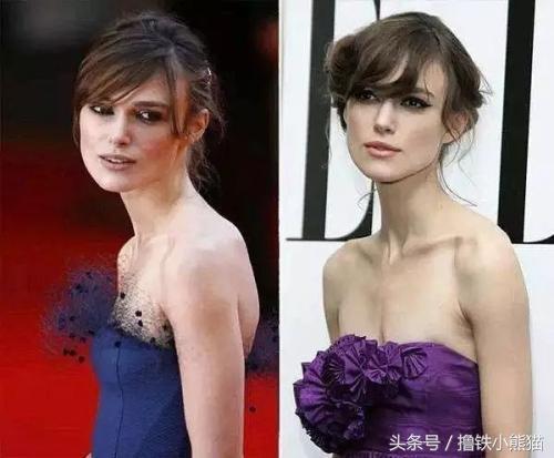 把驼背变成直背,舞蹈驼背应当怎样把背练直呢