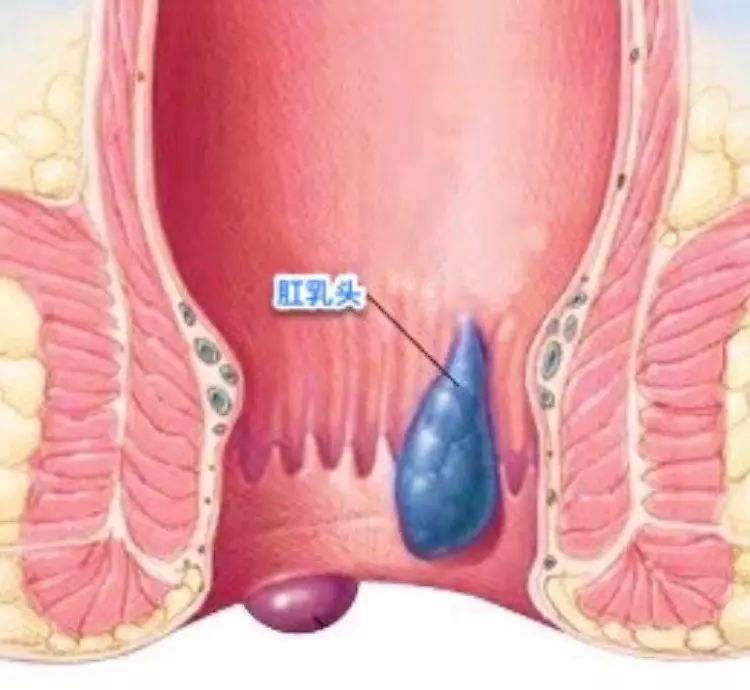怎么判断自己是否有hpv,怎么判断自己是否有耳结石