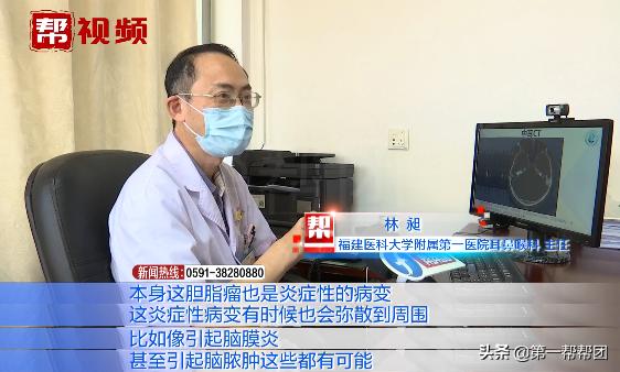 右眼皮长期跳是脑瘤,眼皮跳的频繁是颅内癌症的预兆吗