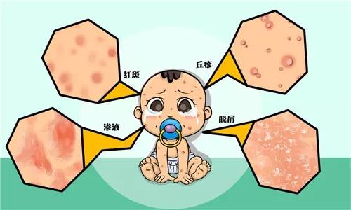 又到猫癣高发期,新生儿热疹和湿疹的预防与护理