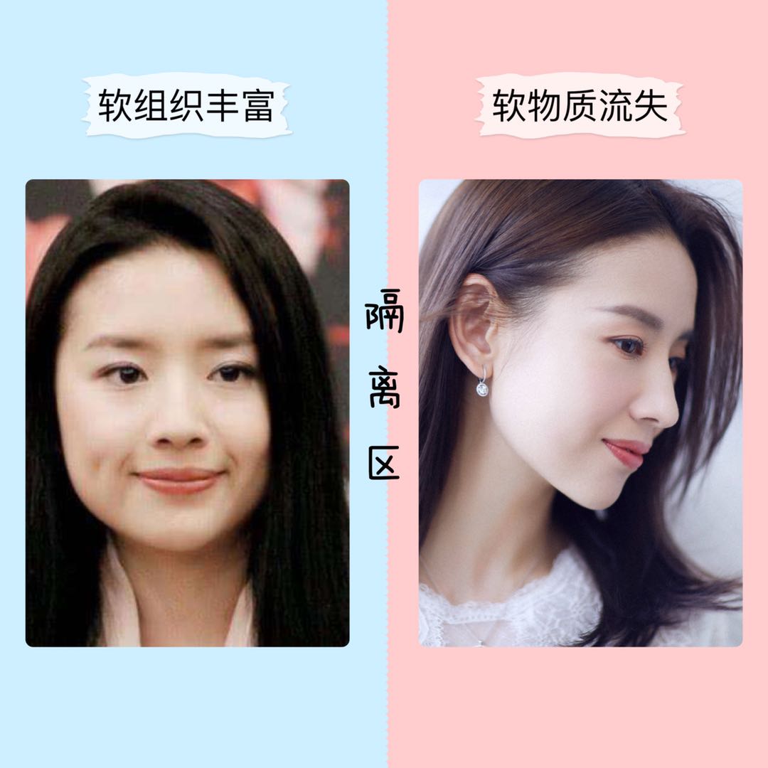 按摩脸部可以消除法令纹？郑爽、范冰冰亲自示范，我劝你别按了