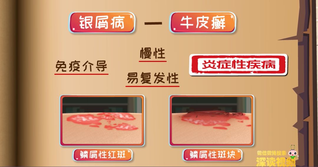 皮肤小红斑,皮肤小红点问题大全解答
