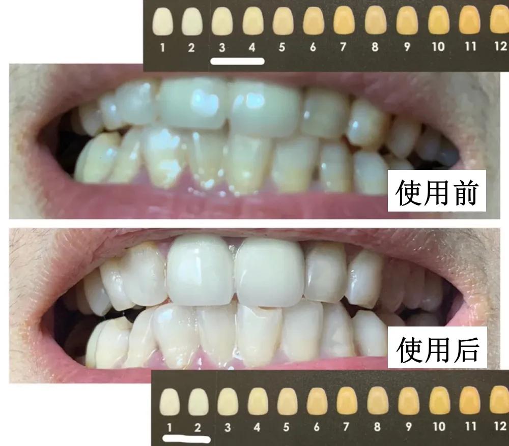 口腔专用香水,能持久留香的口腔香水