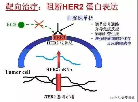 关注乳腺癌的靶向治疗，你又知道多少？