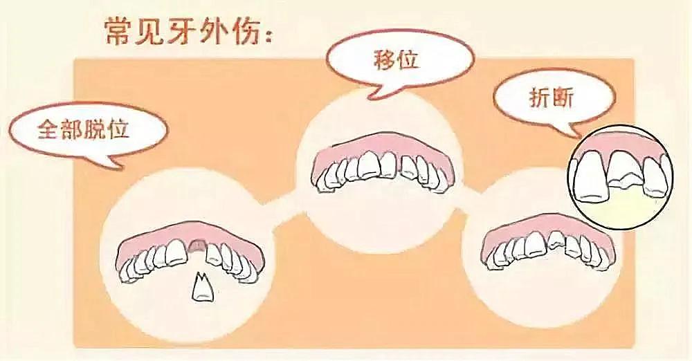 小伙吃未熟烤全羊,小伙吃龙虾牙齿崩了