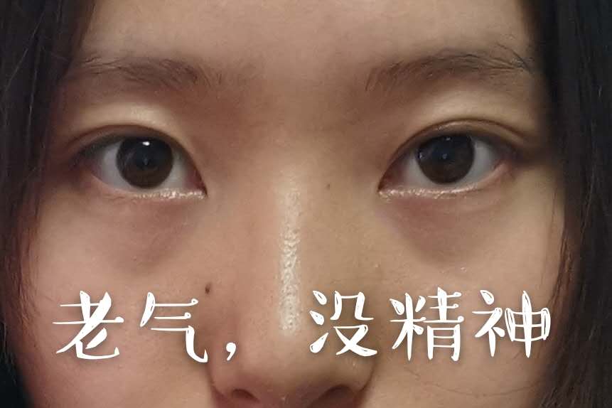 自然光遮泪沟黑眼圈教程,最全黑眼圈泪沟遮瑕大法