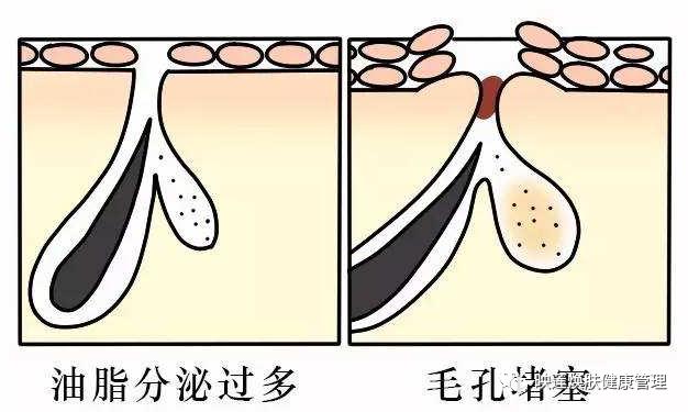 脸部皮肤严重缺水怎么调理,皮肤油光暗沉怎么办