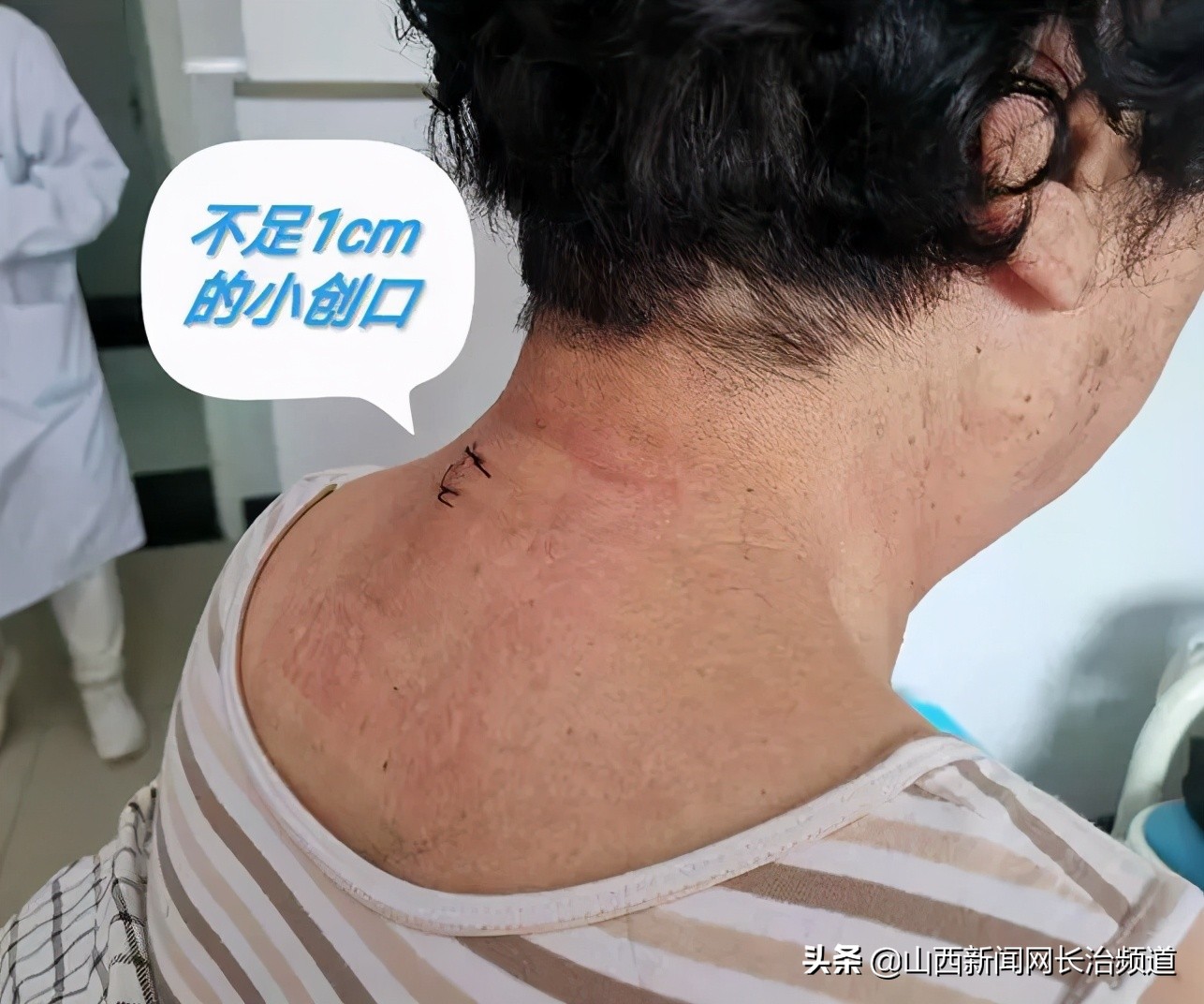 和平技术|疼起来要命的颈椎，一个“钥匙孔”搞定