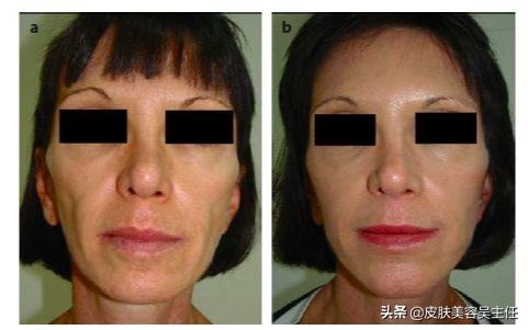 平常人能好看到什么程度,人能漂亮到几岁