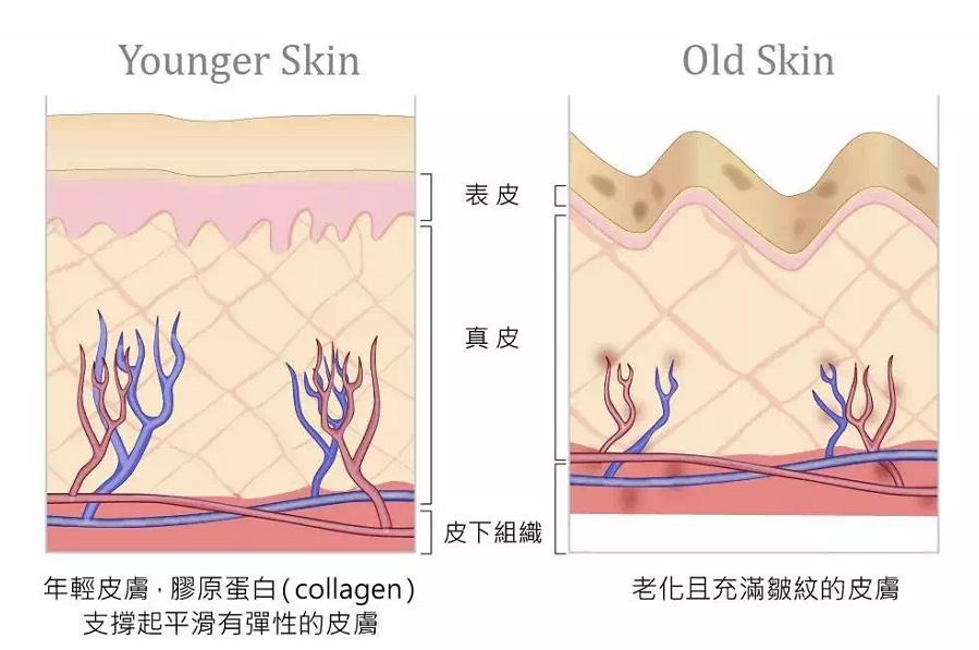 热拉提2.0好还是热玛吉好,热拉提跟热玛吉哪个性价比高