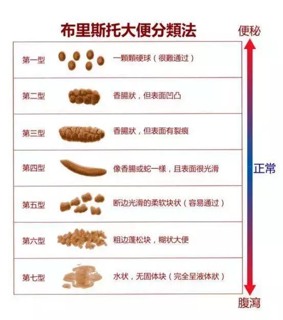 新手爸妈稳住！手把手教你看懂千姿百态大便便（超全观察指南）