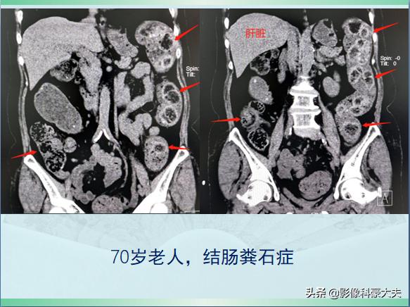 老人去世送盘缠经文,老人死后送盘缠的说法