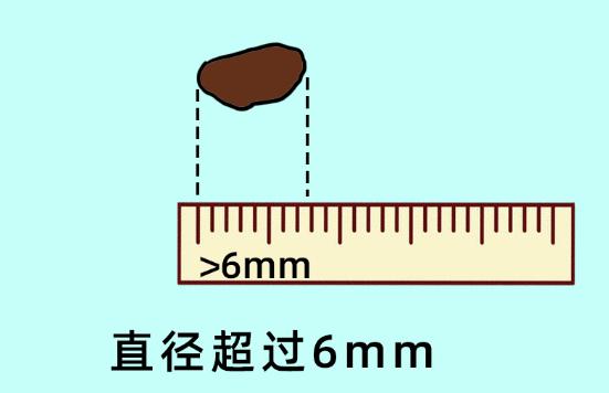 科普一颗平淡无奇的痣竟然会癌变,痣癌变的信号有哪些