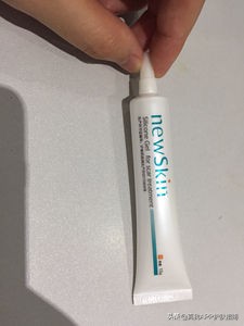 你脸上的痘印属于哪种？怎么形成的？又该怎么消除？
