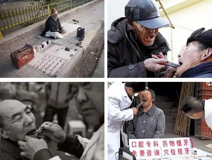牙医拔牙有什么禁忌,牙医拔牙怎么那么轻松
