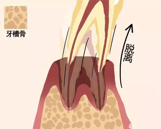 一颗牙齿的动画图片,牙齿脱落过程图解