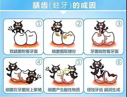 100元补的牙能坚持多少年,要根管治疗的牙久拖不治会如何