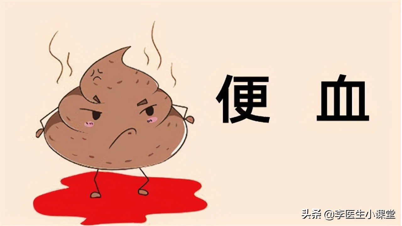 48岁阿姨便血半年，查出晚期肠癌，身体若有这3种情况，及时就医