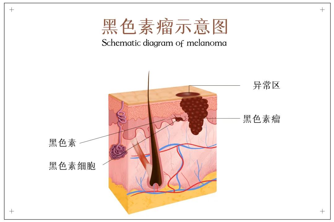 中国科学院附属浙江省癌症医院,中国科学院第一医院癌症内科