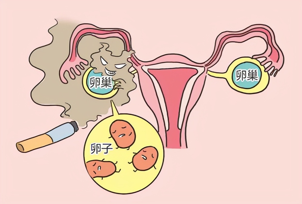 女人切除了子宫，会有什么变化？4种结果，希望能做好心理准备